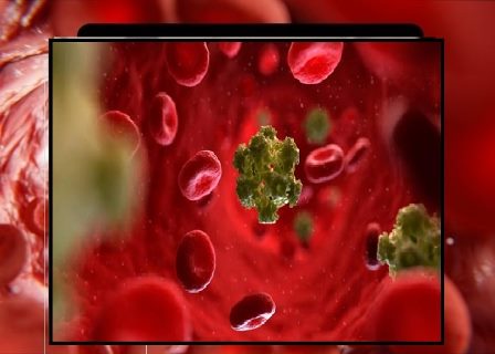 این مقالهای به تأثیرات روانی و اجتماعی ویروس پاپیلومای انسانی اچ پی@وی (HPV) بر زنان ایرانی با تمرکز بر انگ اجتماعی، خودسرزنشگری، اضطراب، افسردگی و نیاز به مداخلات روانشناختی میپردازد.*